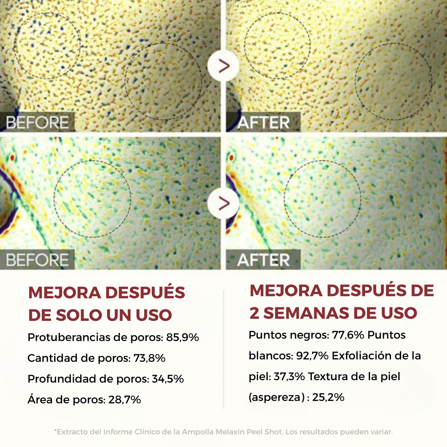Sérum Exfoliante de Arroz – Piel Lisa y Radiante