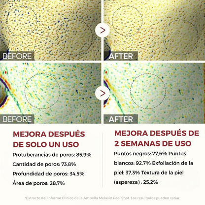 Sérum Exfoliante de Arroz – Piel Lisa y Radiante